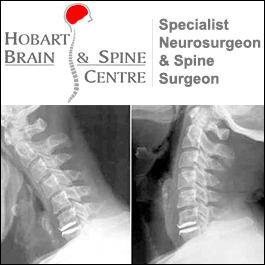 Hobart Brain And Spine Centre