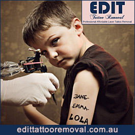 Edit Tattoo Removal