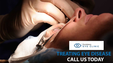 Bundaberg Eye Clinic Hero Image
