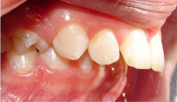 Active Orthodontics - Pialba, QLD
