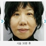 Jj Miracle Plastic Surgery Center