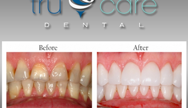 Tru Care Dental - Albuquerque, NM