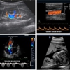 Ultrasound mobile services gallery