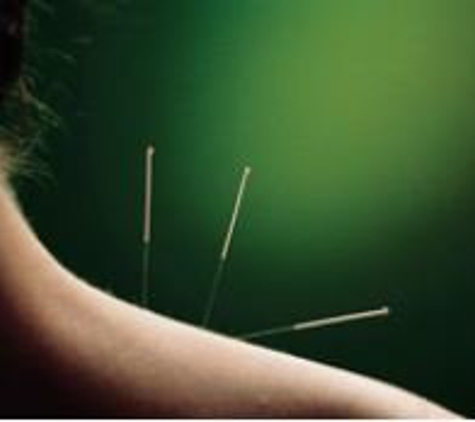 Acupuncture for Pain & Infertility - Ambler, PA