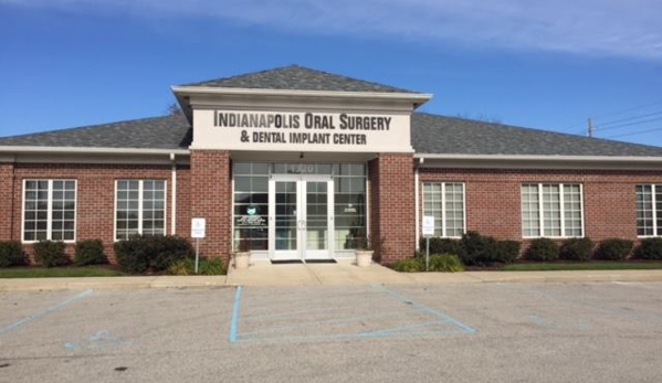 Falender Oral Surgery & Dental Implant Center - Indianapolis, IN