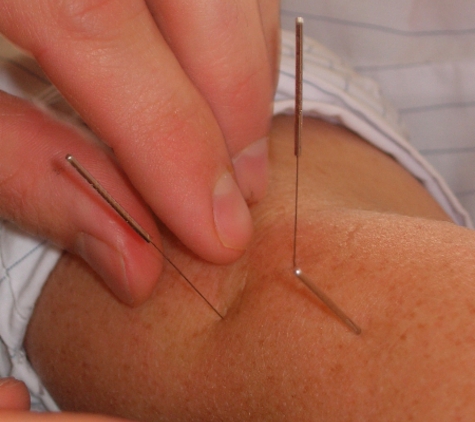 Nelson Bay Physiotherapy - Salamander Bay, NSW