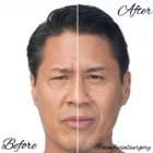 Kim Facial Plastic Surgery