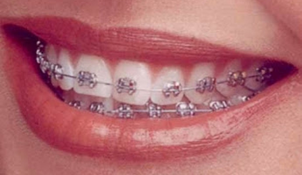 Smiles By Alex - Fountain Valley, CA. Orthodontics Fountain Valley, CA
