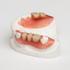 A Plus Dental Lab gallery