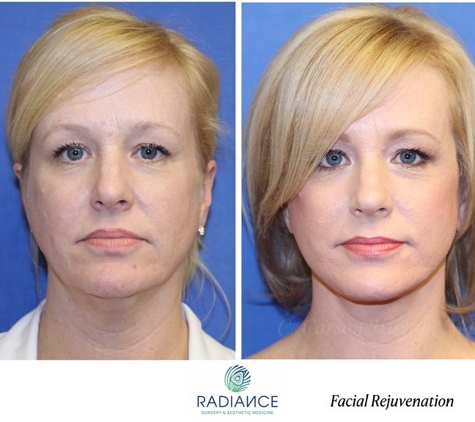 Dr. Cang C Huynh, MD, DMD - Atlanta, GA. Facial Rejuvenation Surgery