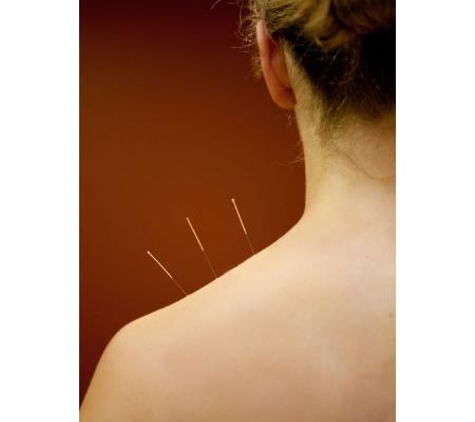 Carter Chiropractic & Dubbo Acupuncture - Dubbo, NSW