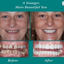 TLC Dental - Implant Dentistry