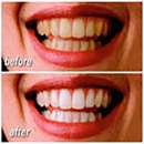 Advance Dental Care - Dentists