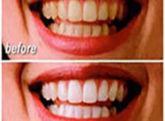 Advance Dental Care - Mahwah, NJ