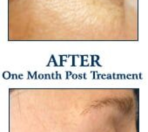 Idaho Dermatologic Surgery & Laser Center - Boise, ID