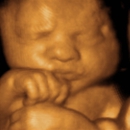 A Little Insight 3d 4d Ultrasound - Medical Imaging Services