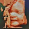 Love At First Sight 3D/4D Ultrasound Imaging Studio gallery