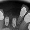 Dr Smilee Dental of Killeen, Family, Cosmetic, Implant, Medspa - Dentists