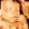 Clear Image 4D Ultrasound : Staten Island gallery