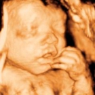 Clear Image 4D Ultrasound : Staten Island