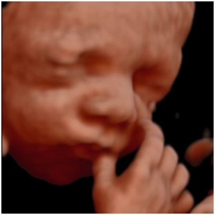 Hello Baby! 4D Ultrasound Studio - Fayetteville, AR