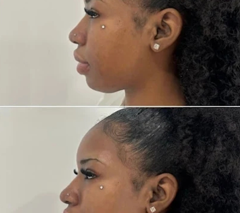 BeautyFULL Cosmetic Medical Clinic - Kingscliff, NSW