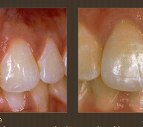 Dentistry of Carlsbad by Maricelle R. Ortiz-Luis, DDS - Carlsbad, CA