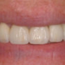 Glenlake Dental Care - Dental Hygienists