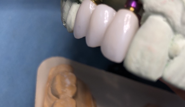 Precision Dental Ceramics Laboratory - Houston, TX