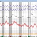 JNE Polygraph - Legal Service Plans