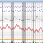 JNE Polygraph