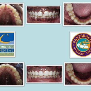 Camenzuli Dental Excellence - New Orleans, LA