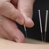 Acupuncture AAA & I gallery