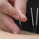 Acupuncture AAA & I - Acupuncture
