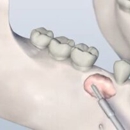 Philip M Robitaille, D.D.S. & Associates - Dental Hygienists