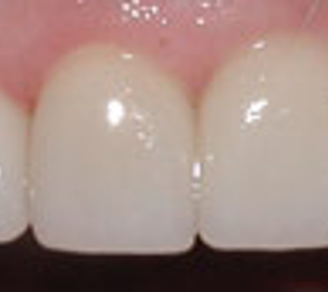 Starwhite Dental - Murrieta, CA