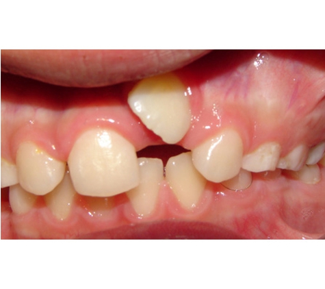 Active Orthodontics - Maryborough, QLD