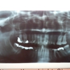 Affordable Dentist Zion Crossroads gallery