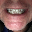 Manickas A Peter - Prosthodontists & Denture Centers