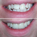 OrthoSnap New York - Orthodontists