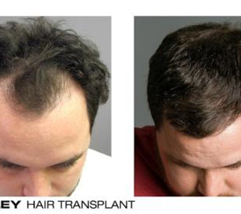 Bosley - Hair Restoration & Transplant - Denver - Greenwood Village, CO