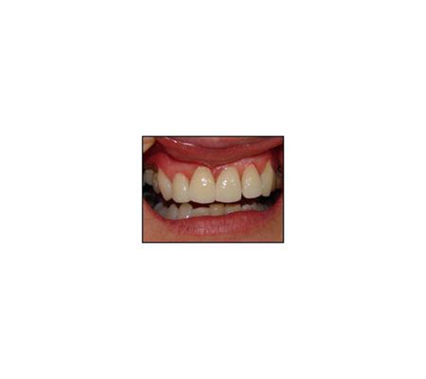 Carseldine Dental - Carseldine, QLD