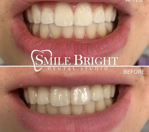 Smile Bright Dental Studio - Katy, TX