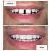 Almaden Valley Smile Design gallery