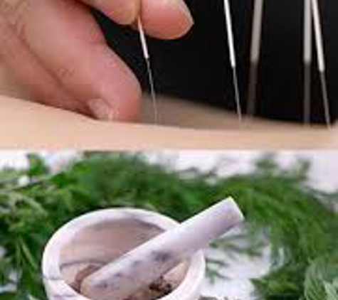 Huntsville Wellness: Acupuncture & Naturopathy - Huntsville, AL. Dr. Mick uses acupuncture and herbal medicine for a completely natural approach