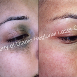 Diablo Regional Laser Center - Walnut Creek, CA