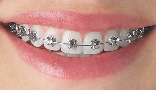 True Image Orthodontics - Cypress, TX