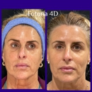 Medical Laser @ Aesthetics - Medical Spas