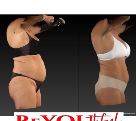 BeYoutiful by Ultraslim - Lubbock, TX