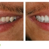 Salt Lake Dental Care - Clint Blackwood DDS gallery